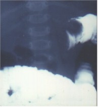 q5