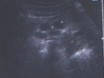 q10